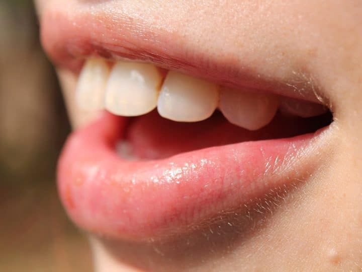 Blanqueamiento dental cosmético sin peróxido: la revolución del PAP en Glow White