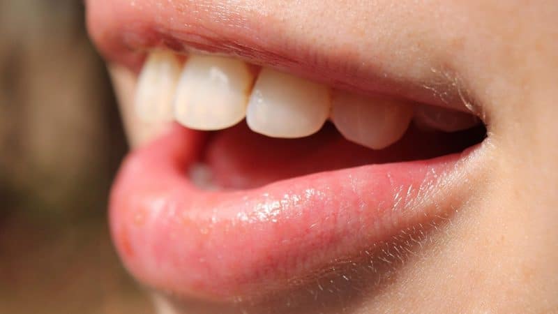 Blanqueamiento dental cosmético sin peróxido: la revolución del PAP en Glow White